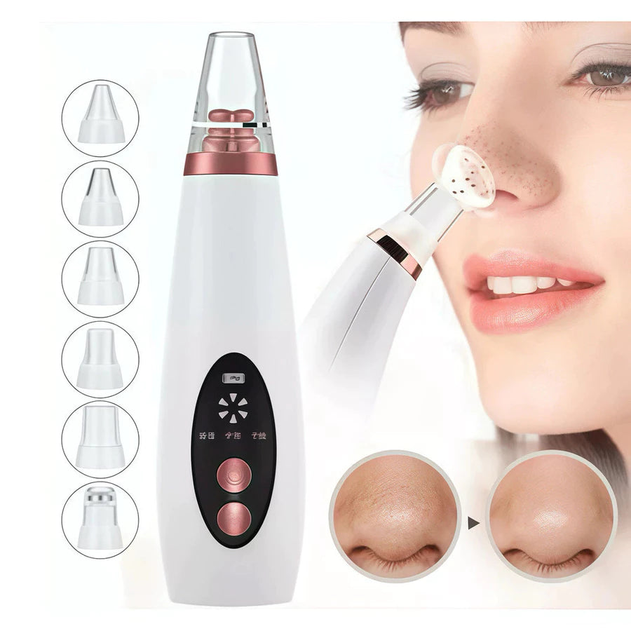 Removedor de Cravos por Sucção – Limpeza Profunda dos Poros